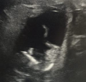 Slack for iOS Upload-4